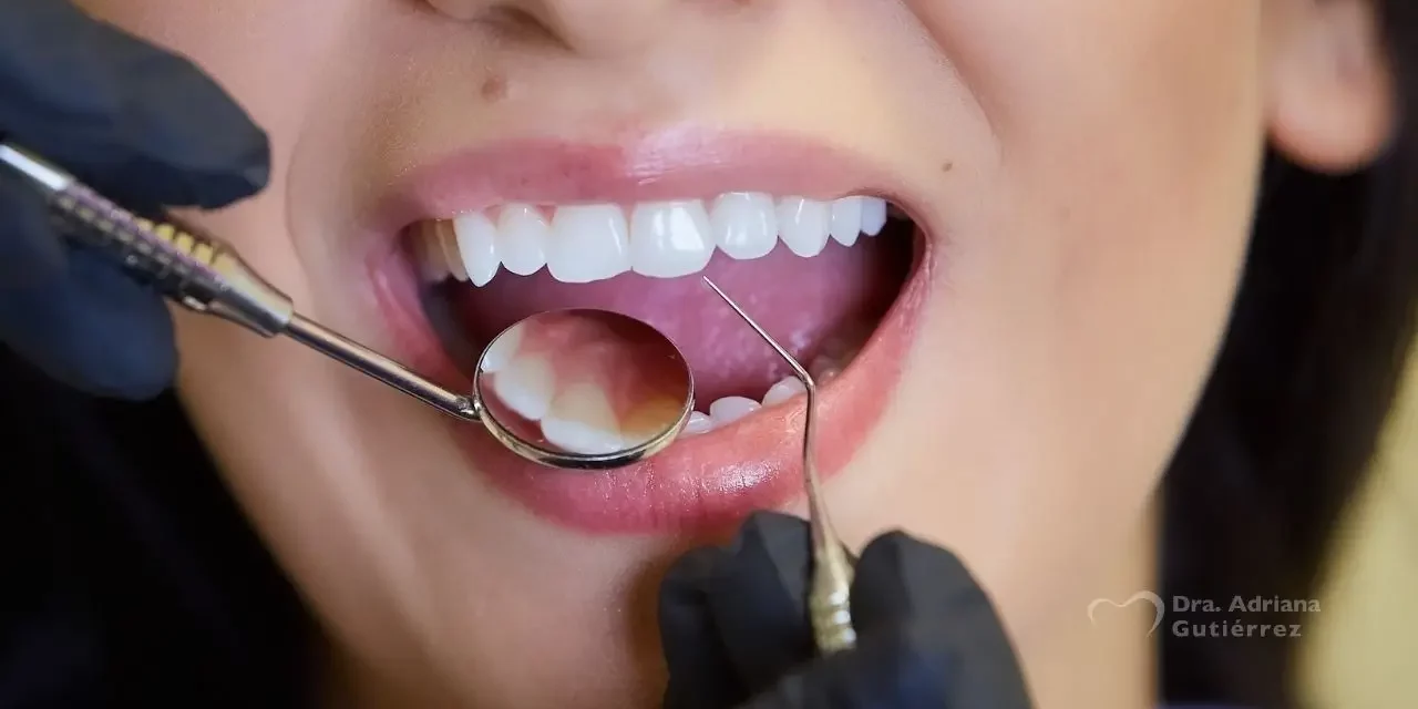 Revisiones periódicas al dentista como método preventivo