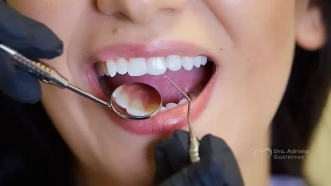 Revisiones periódicas al dentista como método preventivo