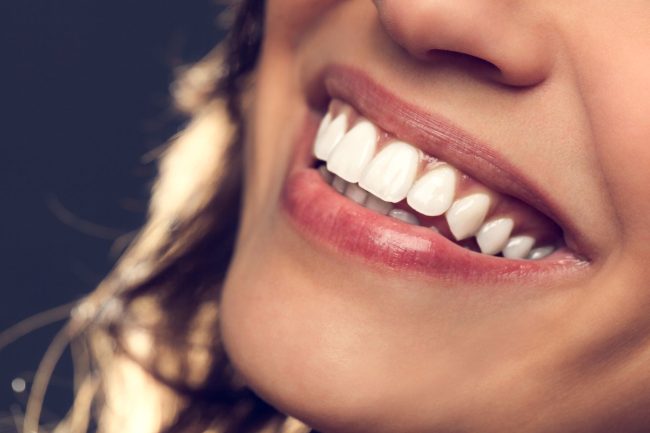 diseno-de-sonrisas-barcelona
