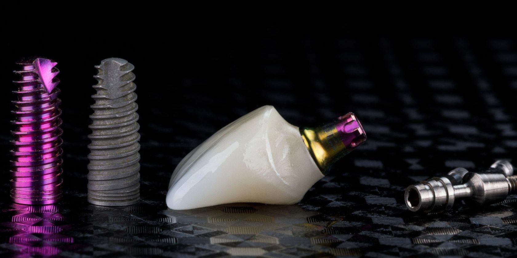 tipos-de-implantes-dentales-barcelona