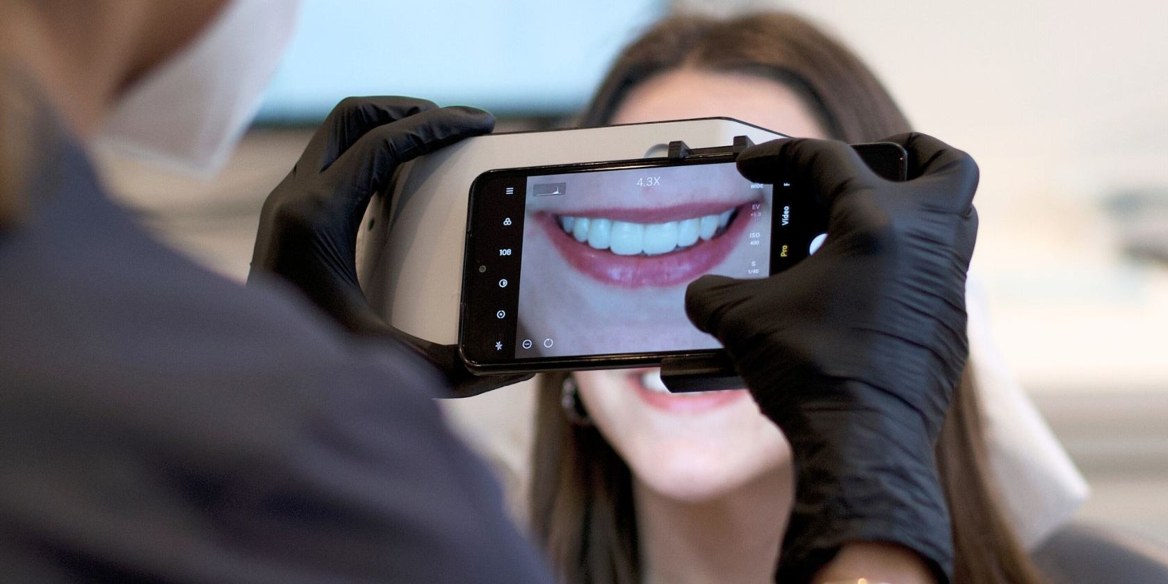 como-se-ponen-las-carillas-dentales como-se-ponen-las-carillas-dentales