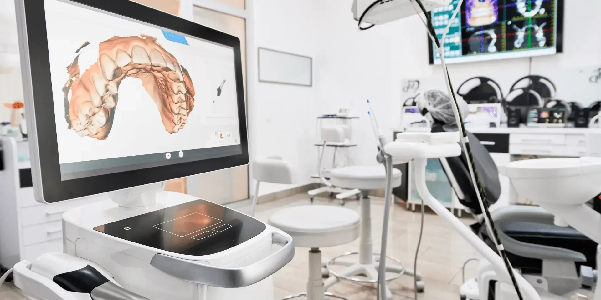 Escáner intraoral para la digitalización 3D de la boca en clínica dental