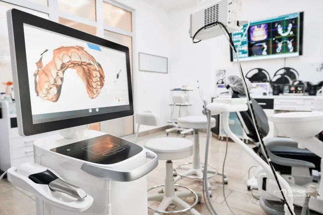 Escáner intraoral para la digitalización 3D de la boca en clínica dental