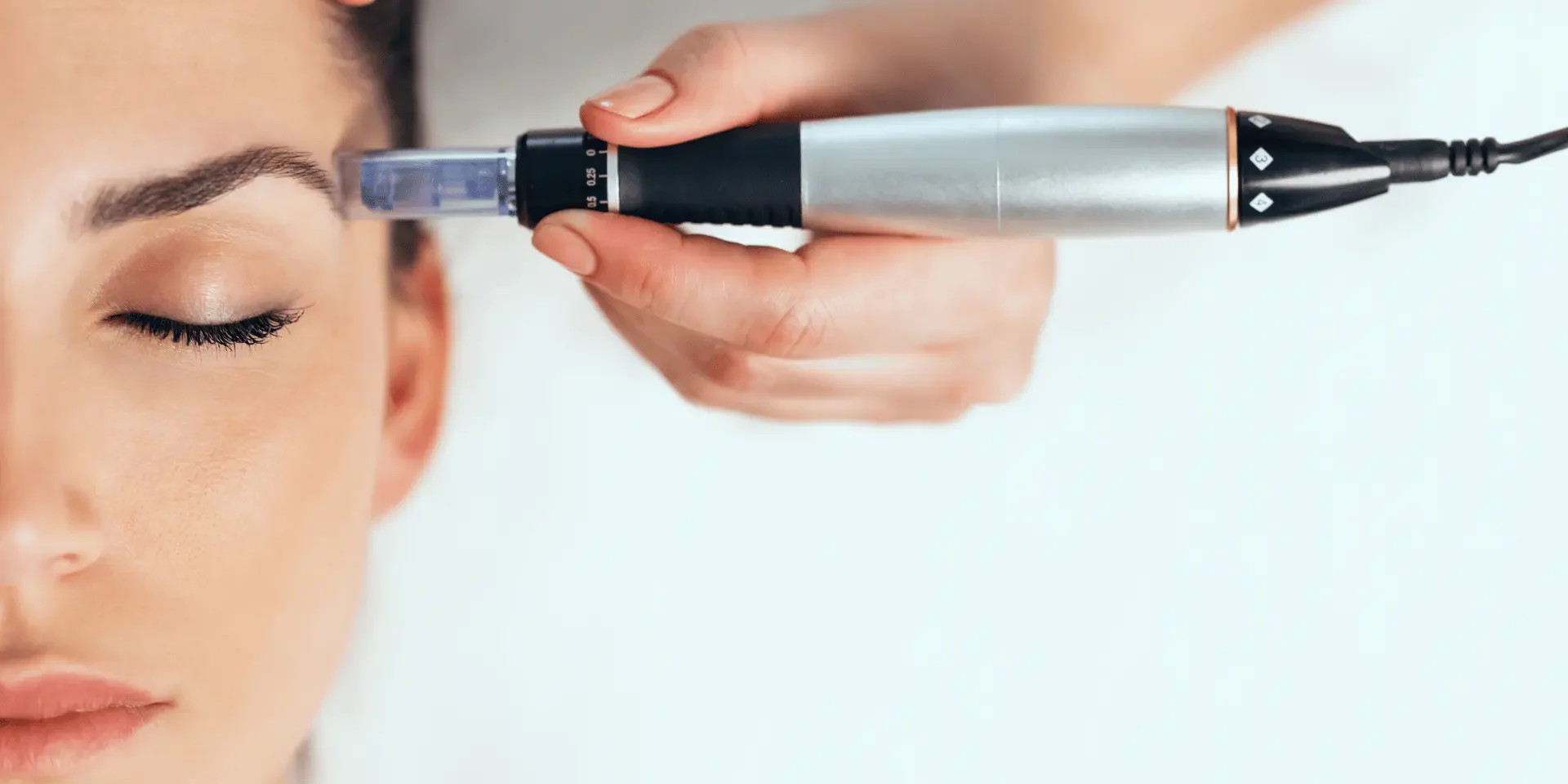 tratamiento de mesoterapia facial para revitalizar y mejorar la calidad de la piel
