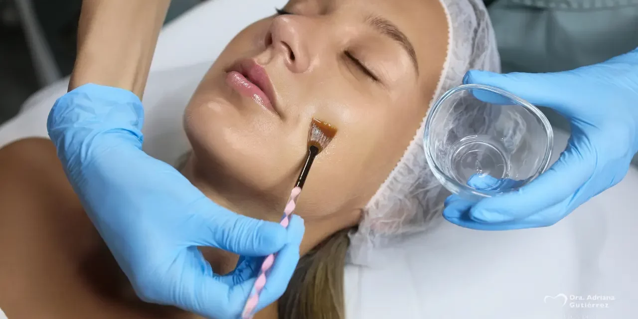 Aplicación de peeling químico facial para mejorar la textura y luminosidad de la piel