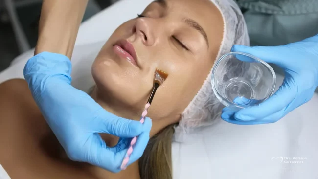 Aplicación de peeling químico facial para mejorar la textura y luminosidad de la piel