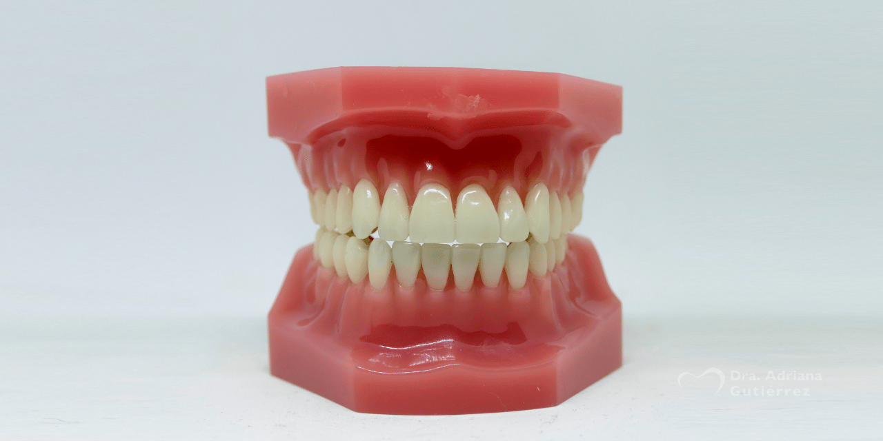 contorneado dental