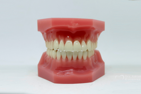 contorneado dental