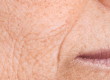 arrugas de la cara