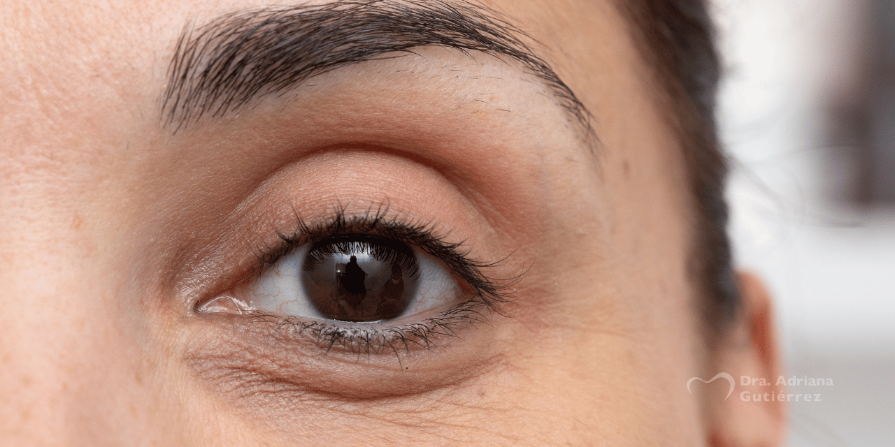 tratamiento ojeras tratamiento ojeras